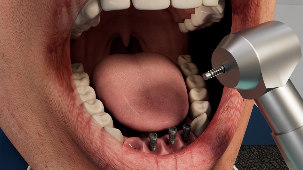 Οδοντιατρική imaging